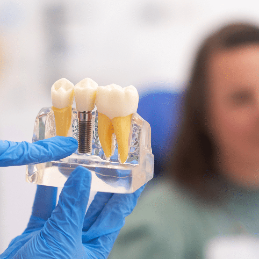 Dentist showing dental implants