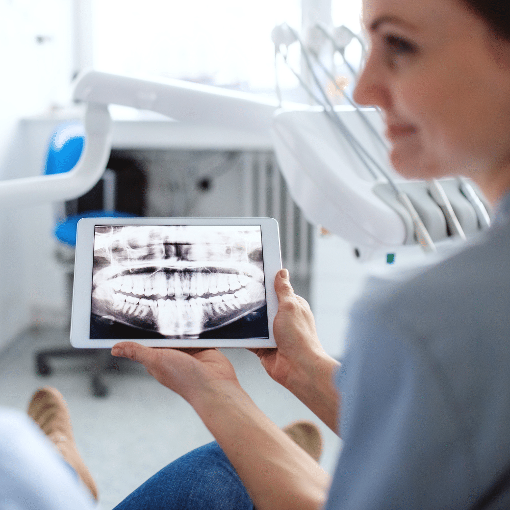Image of digital x-ray